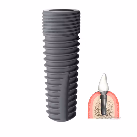 Made in Italy Prosthetic Morse Taper Connections Dental Isykone Implants